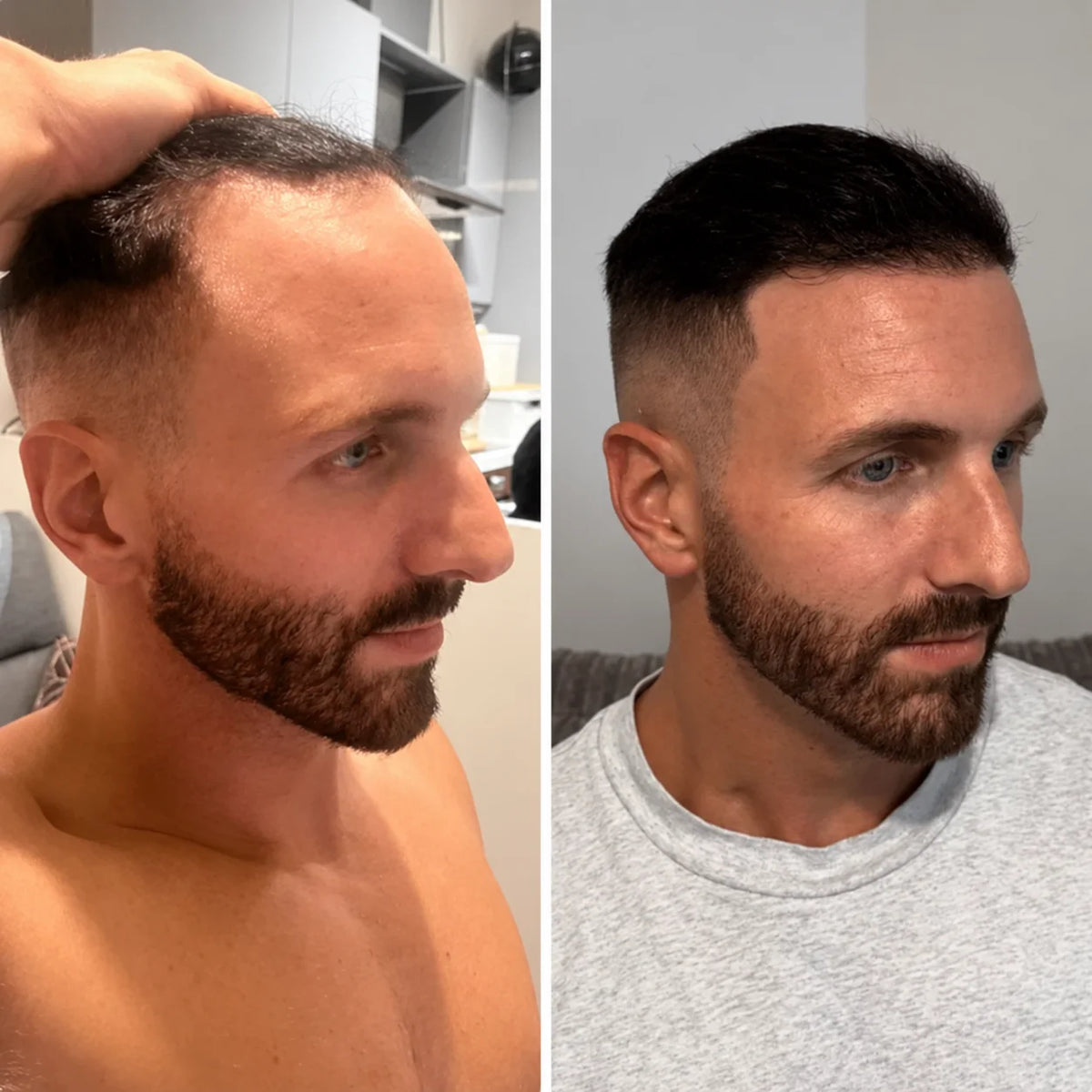 Hårvækstserum roll-on – til tyndt hår